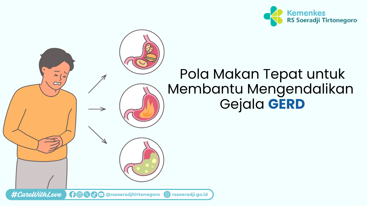 Pola Makan Tepat untuk Membantu Mengendalikan Gejala GERD