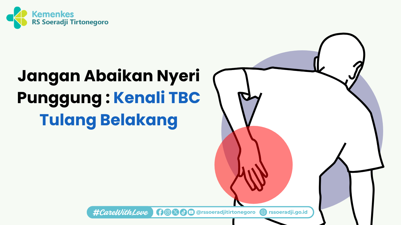 Jangan Abaikan Nyeri Punggung Kenali TBC Tulang Belakang