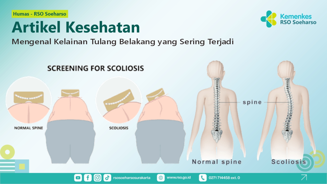 Mengenal Kelainan Tulang Belakang yang Sering Terjadi