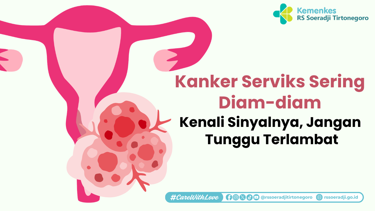 Kanker Serviks Sering Diam diam Kenali Sinyalnya Jangan Tunggu Terlambat