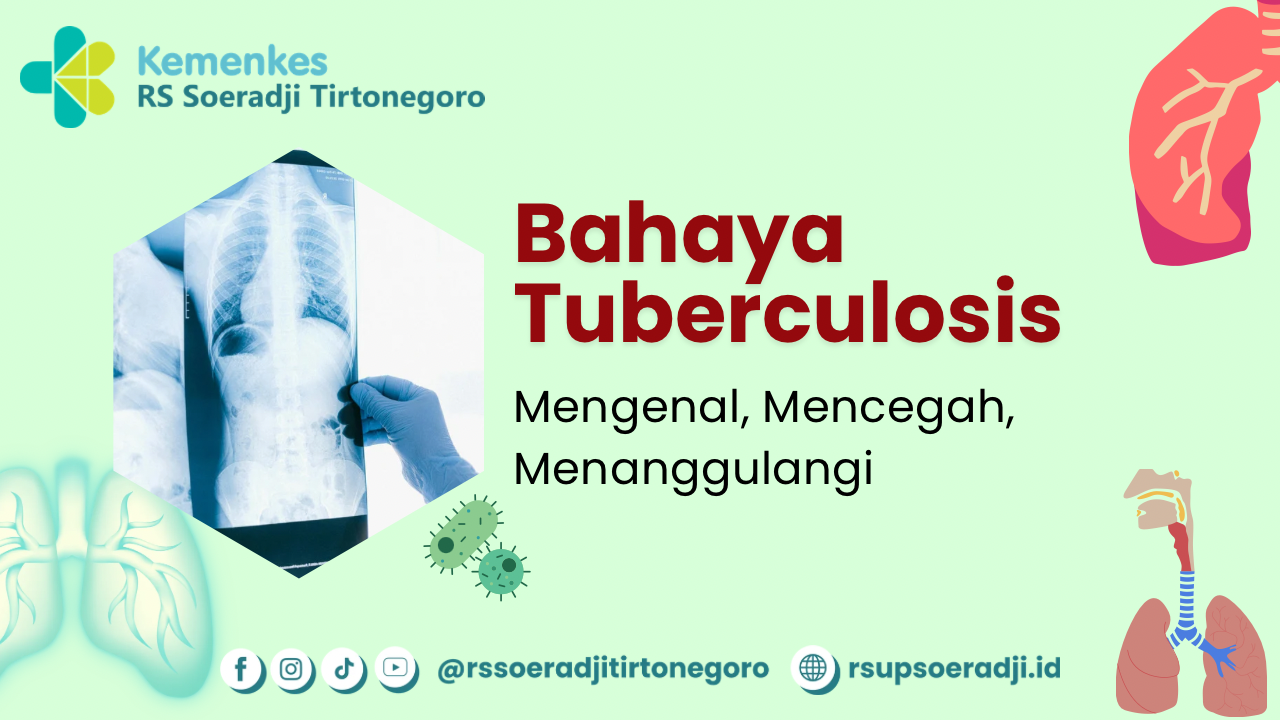 Bahaya Tuberkulosis Mengenal Mencegah Menggulangi