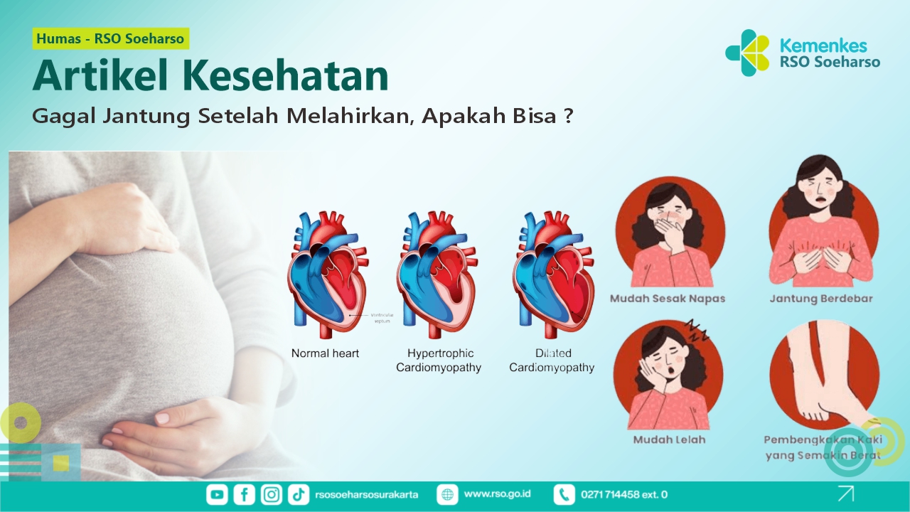 Gagal Jantung Setelah Melahirkan Apakah Bisa