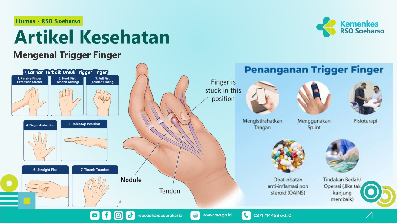 Mengenal Trigger Finger