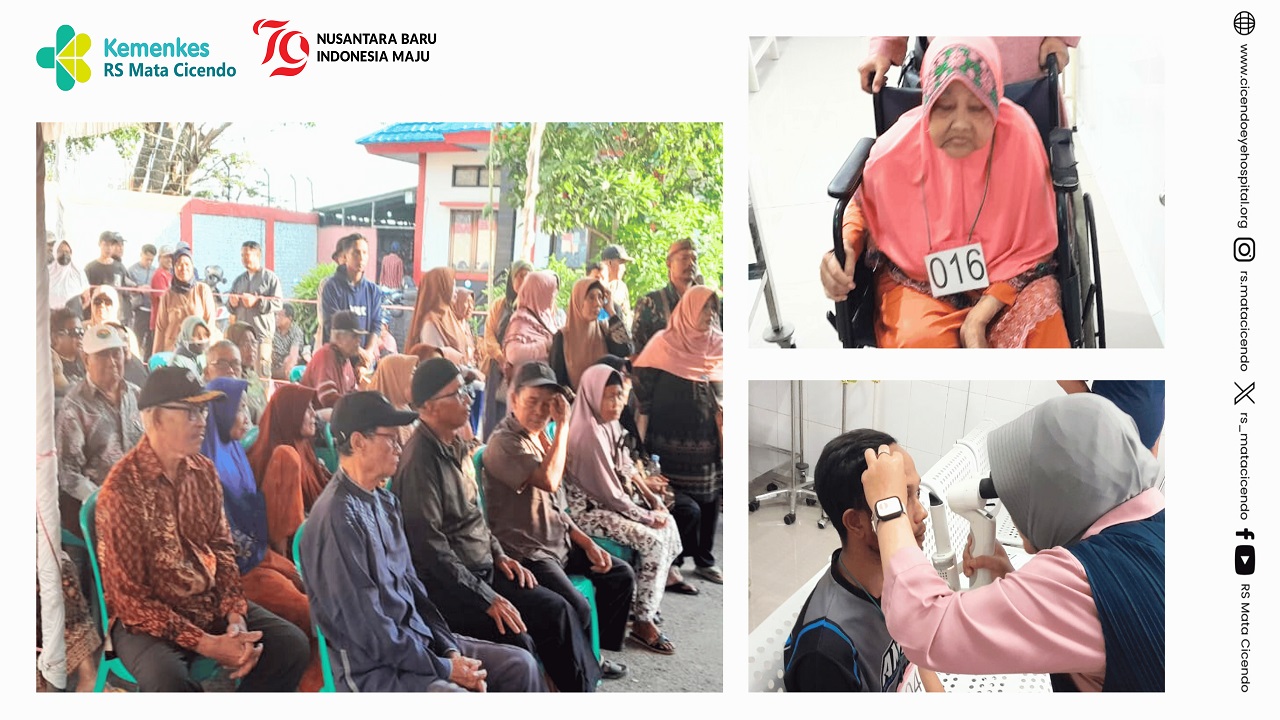 Bakti Sosial Operasi Katarak HUT Kemerde